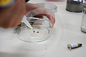 à¹‡Hand is hoiding Micropipettes to drop the extract onto the filter paper on petri dish.