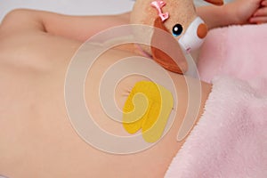 Ð¡hildren belly with glued elastic therapeutic tapeÐ± kinesio taping