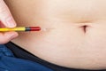 Abdominal insulin injection