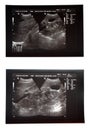 Abdominal pelvic sonography Royalty Free Stock Photo
