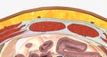 The abdominal wall is made up of a set of layered structures that surround and enclose the abdominal cavity