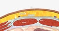 The abdominal wall is made up of a set of layered structures that surround and enclose the abdominal cavity