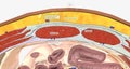 The abdominal wall is made up of a set of layered structures that surround and enclose the abdominal cavity