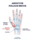 Abductor pollicis brevis muscle with hand and palm bones outline diagram Royalty Free Stock Photo