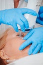 The ablative laser removes the thin outer layer of the skin