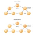 Abnormal Chromosome Inheritance. Nondisjunction. Normal and abnormal meiosis