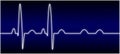 Abnormal EKG Royalty Free Stock Photo
