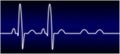 Abnormal EKG