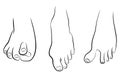 Abnormal feet Royalty Free Stock Photo