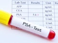 Abnormal high PSA test result