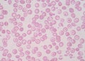 Abnormal red blood cells science background.