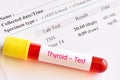 Abnormal thyroid hormone test result