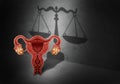 Abortion Law