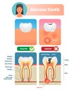 Abscess tooth vector illustration. Labeled medical diagram with structure. Royalty Free Stock Photo