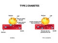 The absorption of glucose by the cell. Type 2 diabetes. Increase