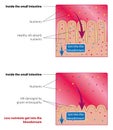 Absorption of nutrients in the small intestine