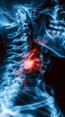 Abstract blue x-ray photograph of back and neck pain, pain glows red. Trauma concept. Medical checkup. Generative AI Royalty Free Stock Photo