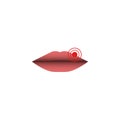 Abstract herpes lips illustration, herpes simplex virus, closeup of female close lips with a target pointing to the HSV-1 source Royalty Free Stock Photo