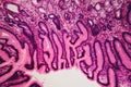 Cell microscopic- pyloric division stomach