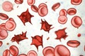 Acanthocytes, abnormal red blood cells with thorn-like projections