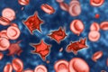 Acanthocytes, abnormal red blood cells with thorn-like projections