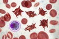 Acanthocytes, abnormal red blood cells with thorn-like projections Royalty Free Stock Photo