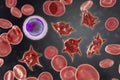 Acanthocytes, abnormal red blood cells with thorn-like projections