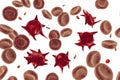 Acanthocytes, abnormal red blood cells with thorn-like projections