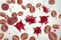 Acanthocytes, abnormal red blood cells with thorn-like projections Royalty Free Stock Photo