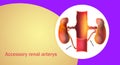 Accessory renal arteries