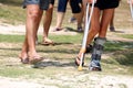 Accident tourist girl are walking by crutches in the garden. Royalty Free Stock Photo