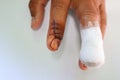 Accidental wounds At the fingers Fingernails, nails, stitches and cure