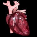 Accurate representation of the human heart section Royalty Free Stock Photo