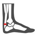 Achilles heel solid icon, Human diseases concept, leg with a sore ankle sign on white background, human feet with pain Royalty Free Stock Photo