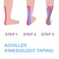 Achilles kinesiology taping.