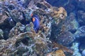 Achilles tang