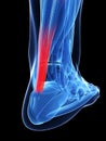 Achilles tendon Royalty Free Stock Photo