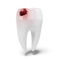 Aching tooth Royalty Free Stock Photo