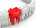 Aching tooth in row of healthy teeth. Royalty Free Stock Photo