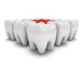 Aching tooth in row of healthy teeth Royalty Free Stock Photo