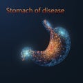 Acid Reflux, Heartburn, GERD, Gastritis. Royalty Free Stock Photo