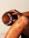 ACL Football injury. Royalty Free Stock Photo