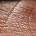 Acne concept. Skin diseases concept. macro skin of human hand.Medicine and dermatology concept. Details of human skin