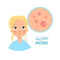 Acne infographics.