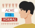 Acne man face, skin problems, flat vector stock illustration as a concept of acceptance of appearance, beauty of different skin