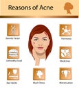 Acne reasons. Skin problems and diseases beauty infographics. Vector illustration. Royalty Free Stock Photo