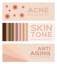 Acne , skin tone and anti aging . 3 banner set