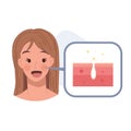 Acne treatment concept. Woman with no skin problem ,no Pimles. a Clean and clear Face. Flat vector cartoon illustration