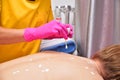 Acne treatment with zinc ointment. The back of a woman. The hands of a cosmetologist smear skin rashes with ointment.