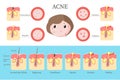Acne types and formation infographics, vector flat illustration